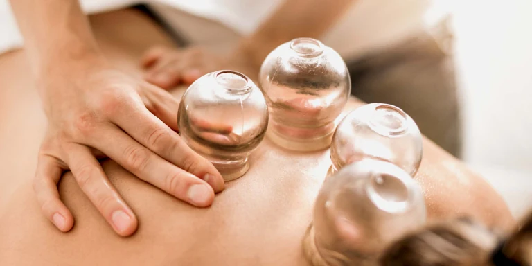 four special cupping cups are placed on the back of a person lying down